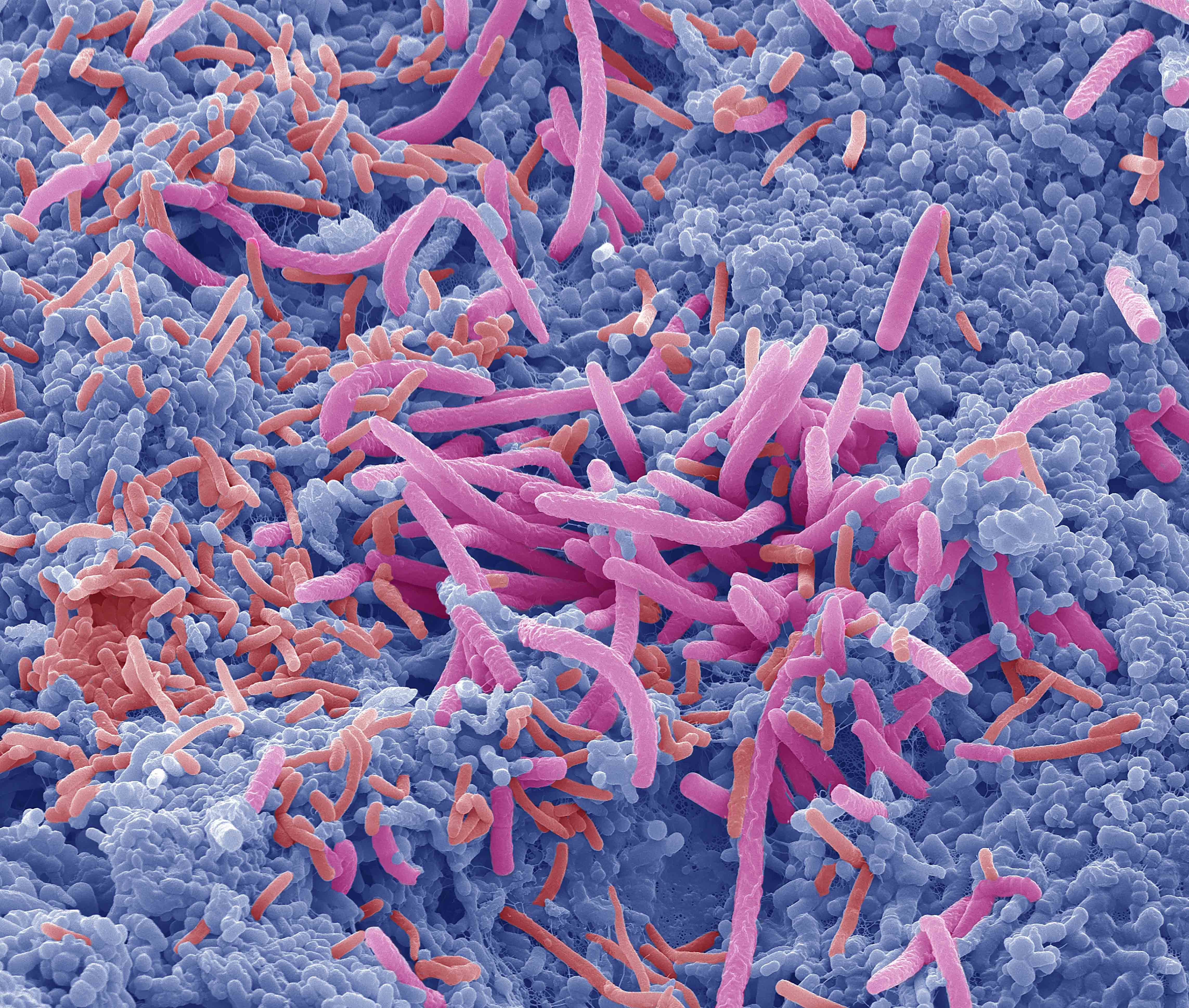 Flora Bacteriana Aumentada: Qué Es, Causas, Síntomas Y Más – LEKPU